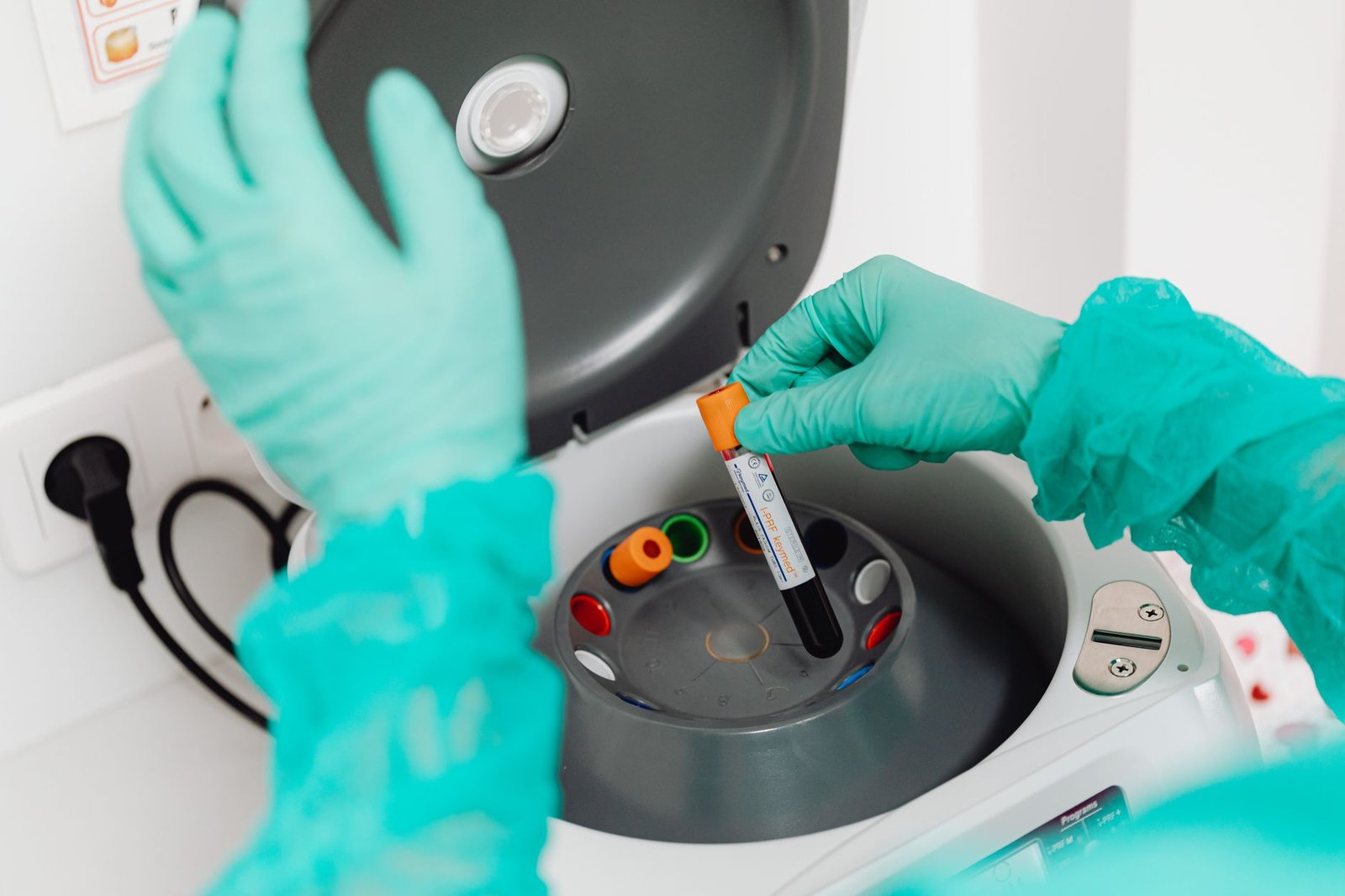 Gloved hands loading a tube of the patient's own blood into a benchtop centrifuge to separate the platelet fraction