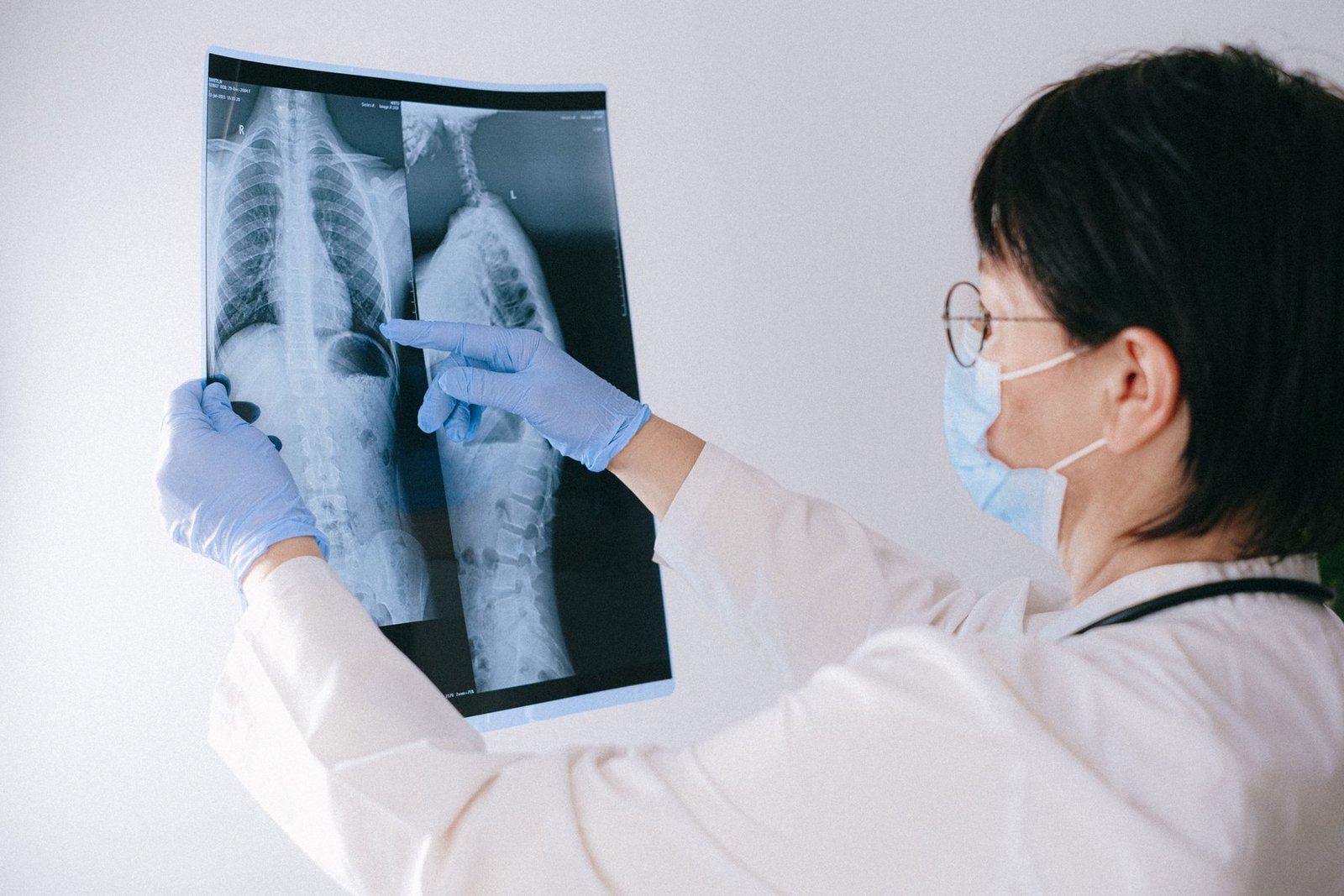 A clinician using a spine model to explain a level